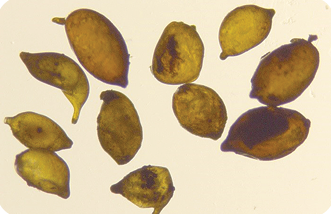microscopic view of female cysts from an SBCN-infested plant