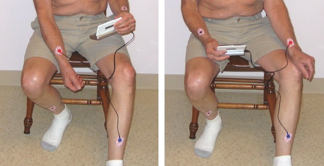 when performing routine electrocardiography you place electrodes on the