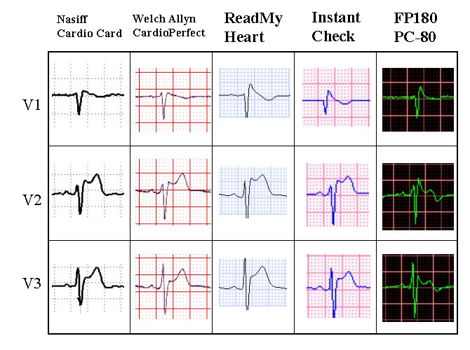 1-lead to 12-lead and exercise ECG