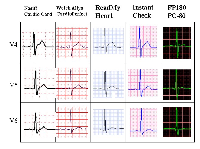 1-lead to 12-lead and exercise ECG