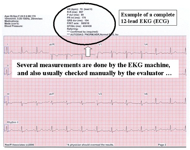 Normal Ecg Values Chart In Ms