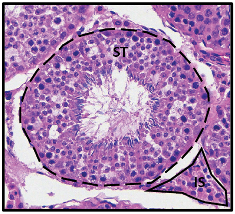 Histology of the testicle. The seminiferous tubule (ST; dashed black line) is the circular structure in the middle of the image, within which Sertoli cells nourish the developing sperm. The interstitial space (IS; solid black line) is the space between ST where testosterone is produced by Leydig cells. 