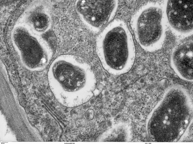 Figure 2. Soybean nodule cross-section micrograph showing individual bacteroids.