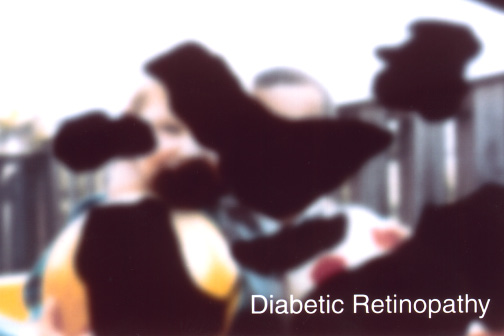 Same scene viewed by a person with diabetic retinopathy