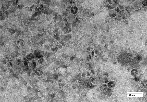 bacteriophage image acquired with JEM-1400 Flash