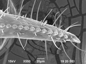 Pseudoscorpion | Electron Microscopy Core | NDSU