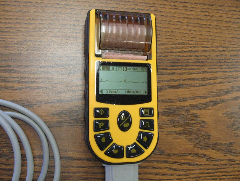 comparative-handheld-ECG80A-2.jpg (179526 bytes)