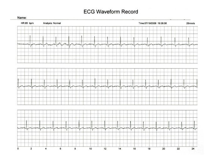 What is the average cost of earning an EKG interpretation certificate?