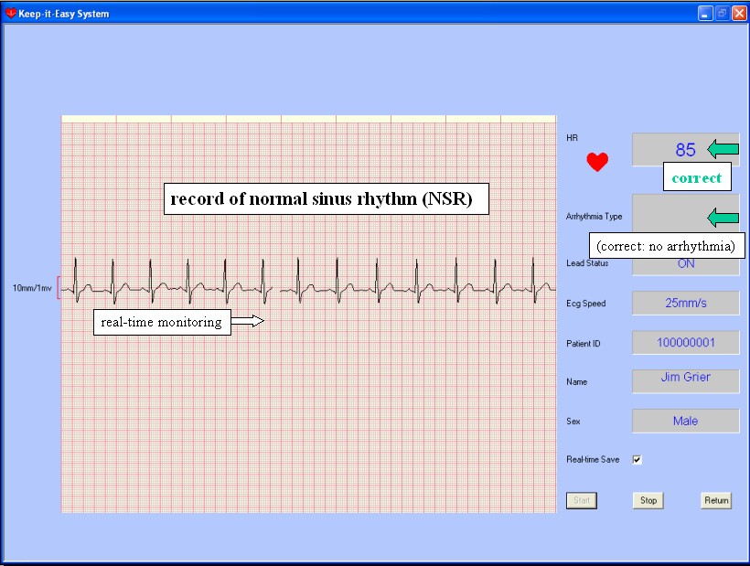  KardiaMobile 1-Lead Personal EKG Monitor – Record EKGs at Home  – Detects AFib and Irregular Arrhythmias – Instant Results in 30 Seconds –  Easy to Use – Works with Most