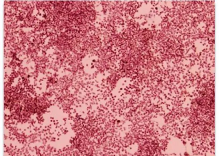 Mammalian Cell Culture Assay