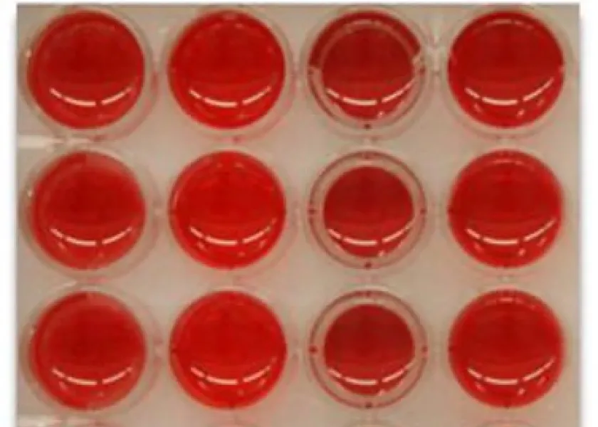 Red blood cell assay