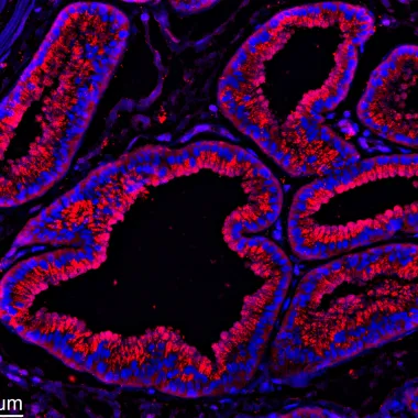 Colorful slide of sheep gland.