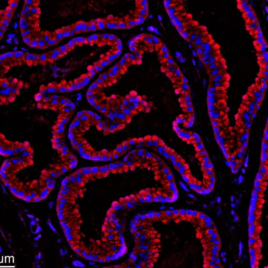Colorful slide of sheep gland.