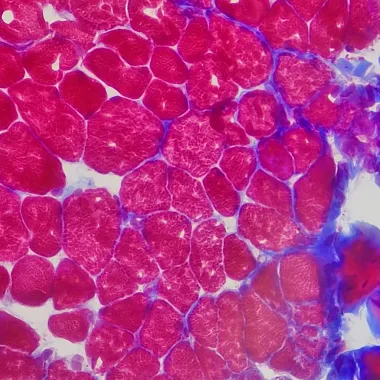 Colorful slide showing muscle tissue.