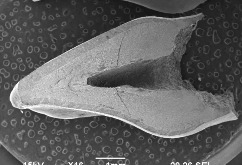 Human deciduous teeth