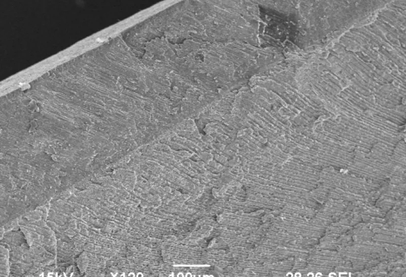 Human deciduous teeth