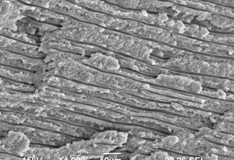 Human deciduous teeth