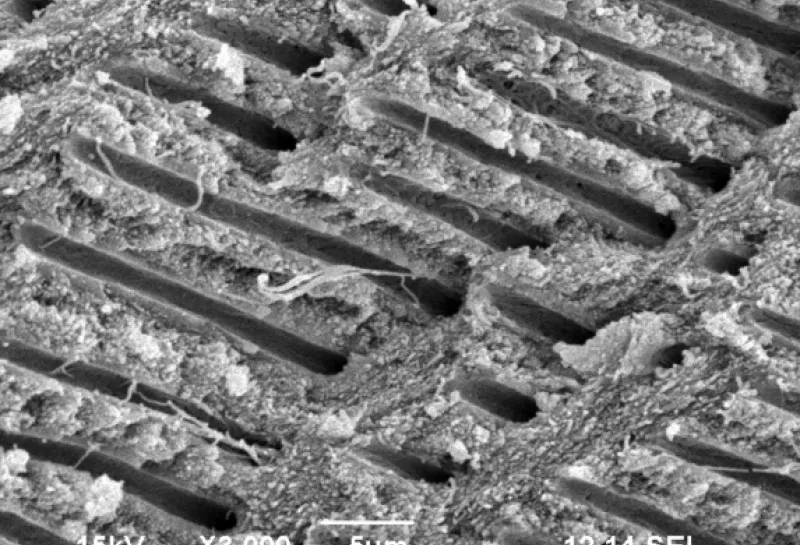 Human deciduous teeth