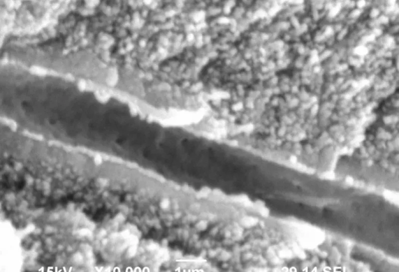 Human deciduous teeth