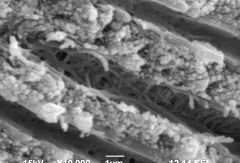 Human deciduous teeth