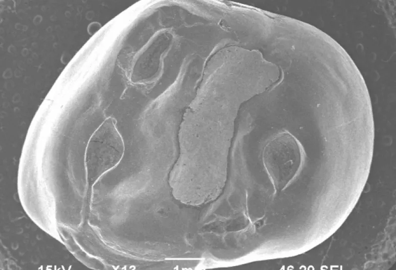 Human deciduous teeth