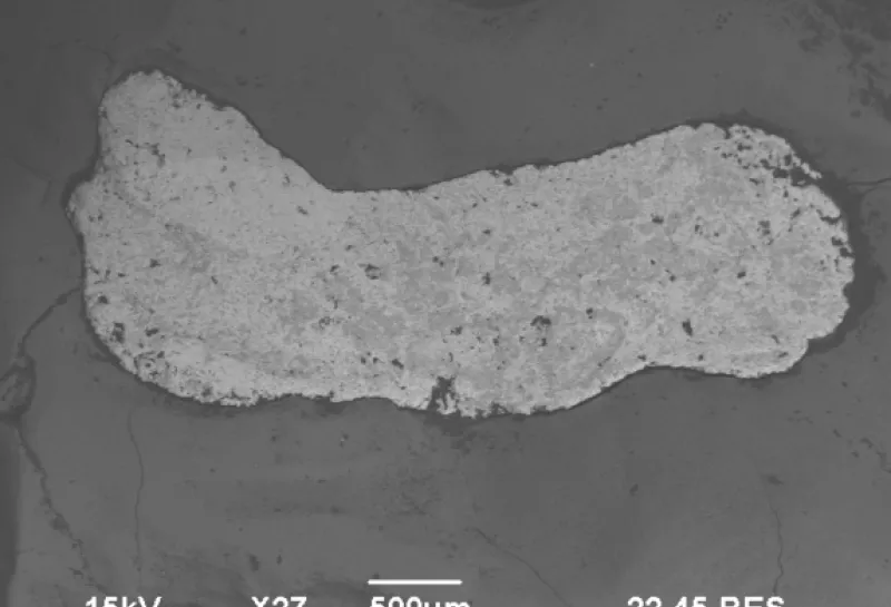 Human deciduous teeth