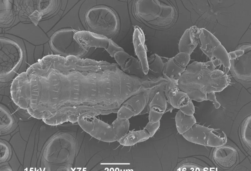 Human head lice Pediculus humanis