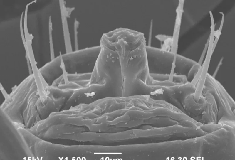 Human head lice Pediculus humanis