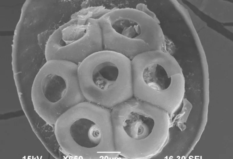 Human head lice Pediculus humanis