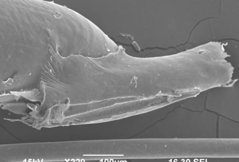 Human head lice Pediculus humanis