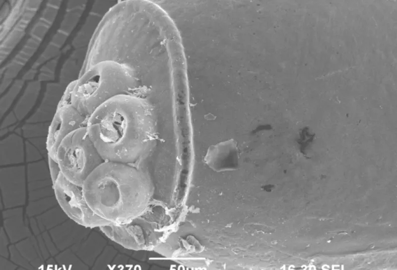 Human head lice Pediculus humanis