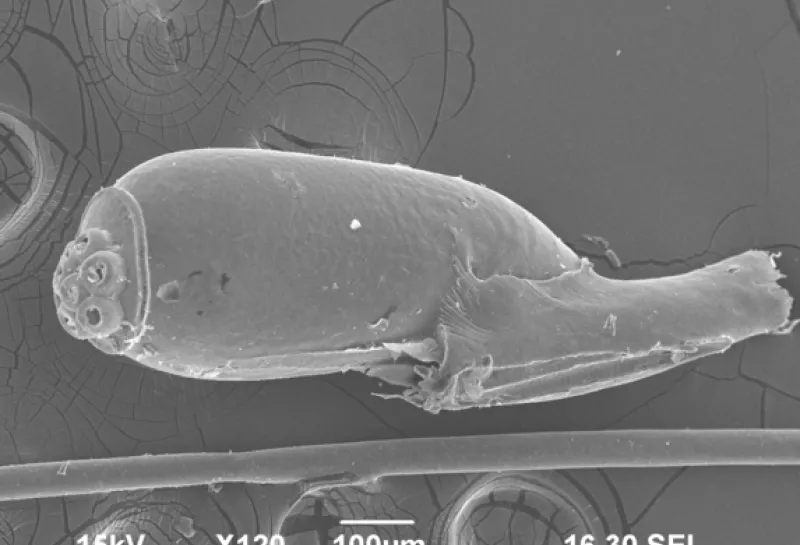 Human head lice Pediculus humanis