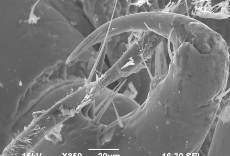 Human head lice Pediculus humanis