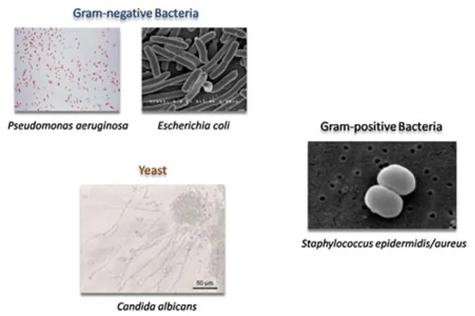 Images of microorganisms under a microscope.