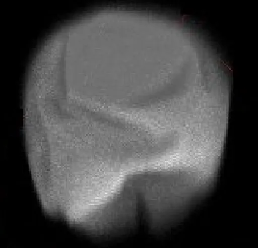zoomed shell