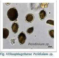 Figure 4. Dinophlagellatae Peridinium sp
